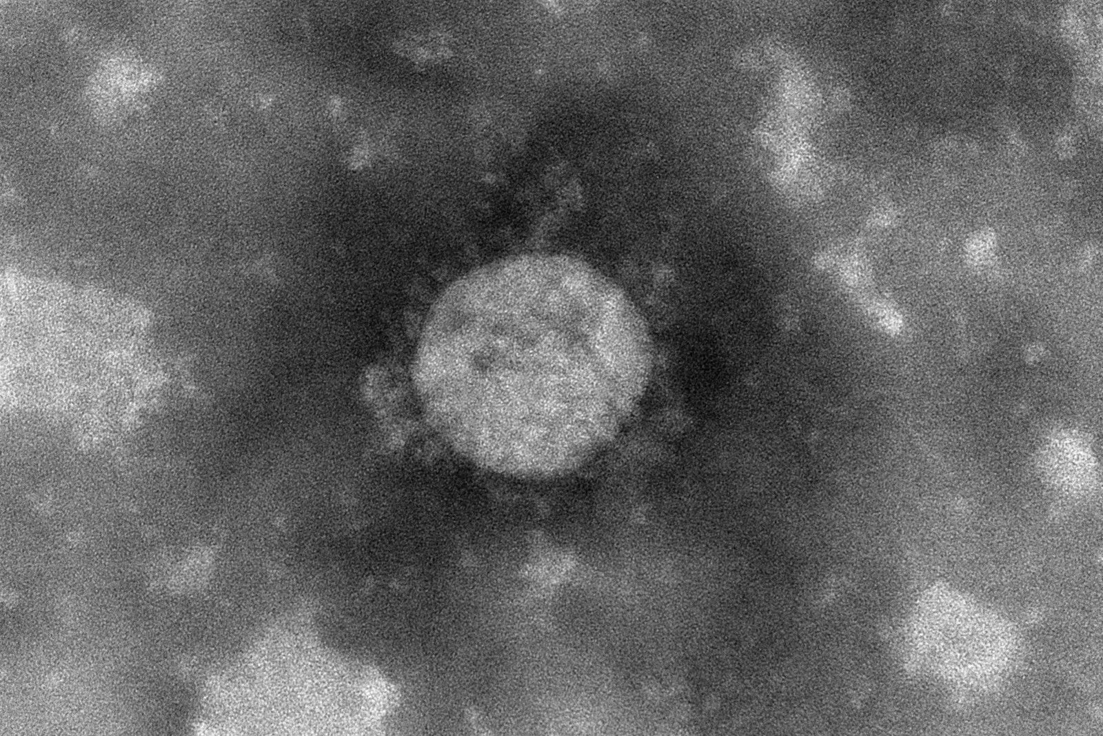 透過型電子顕微鏡写真 ナノイーなし