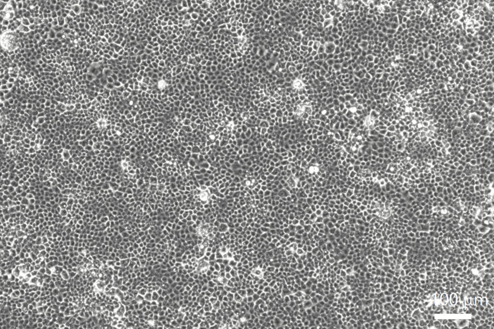 感染拡大観察 ナノイーあり