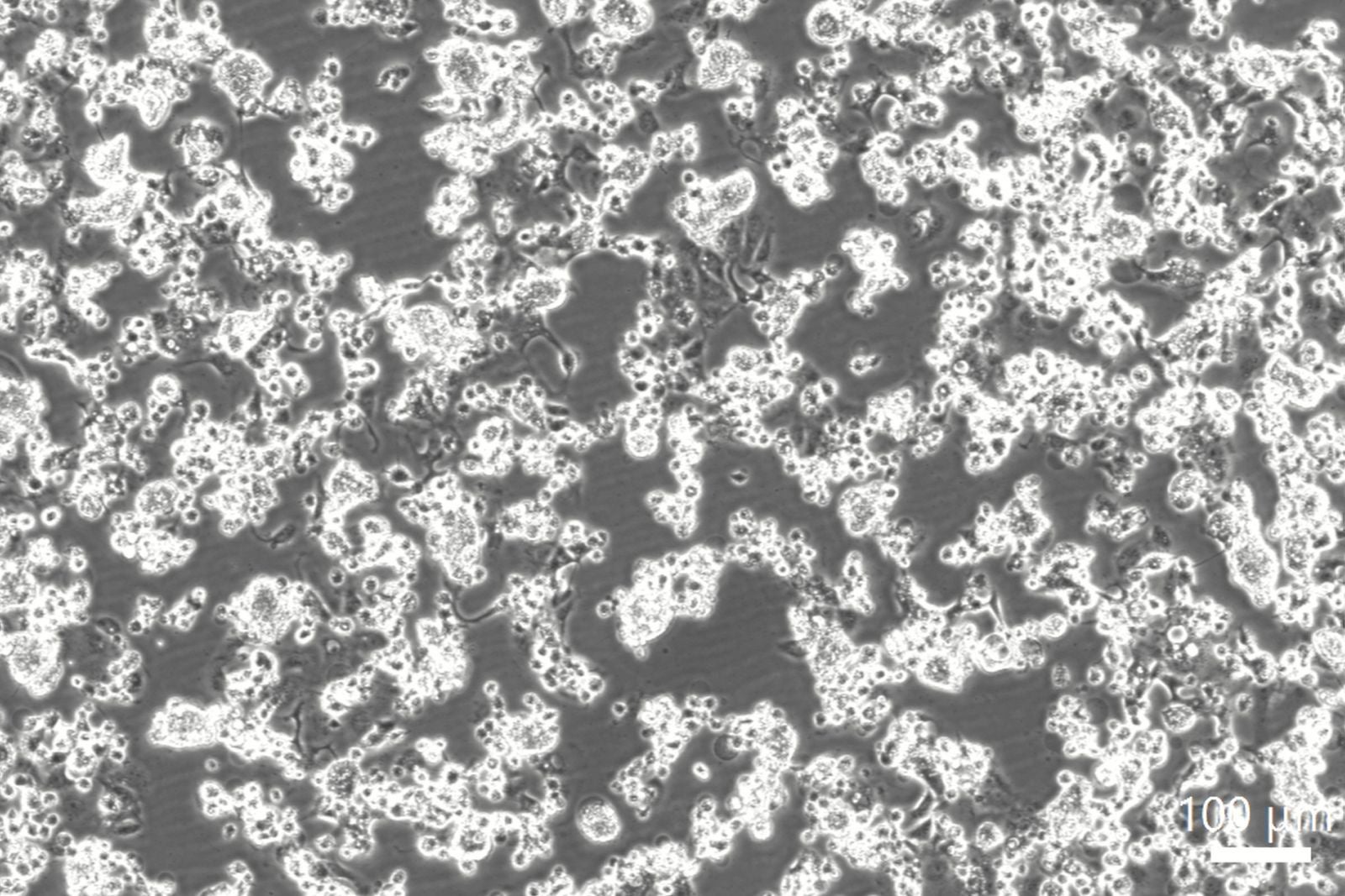 感染拡大観察 ナノイーなし