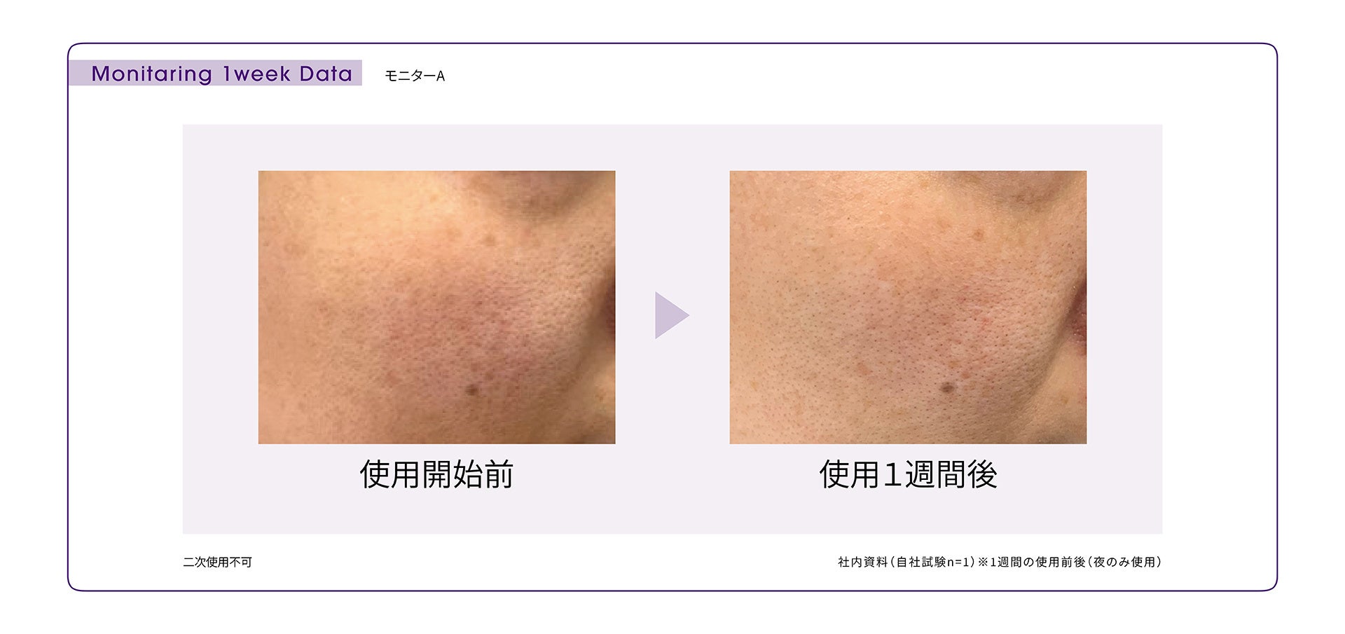 Bb lab.（ビービーラボ）＞7日間の集中ケア。透明感のある