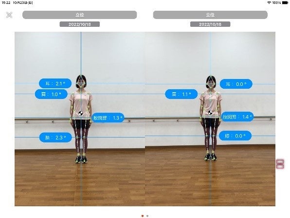 ビフォー・アフター比較評価