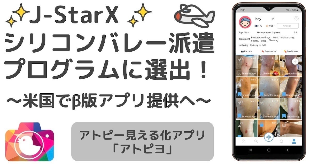 J-StarXシリコンバレー選出-アトピヨ