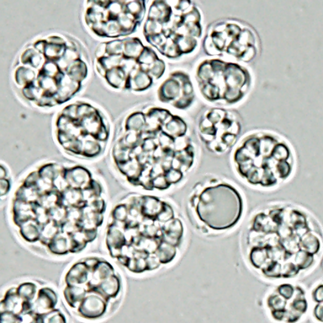 オーランチオキトリウム顕微鏡写真