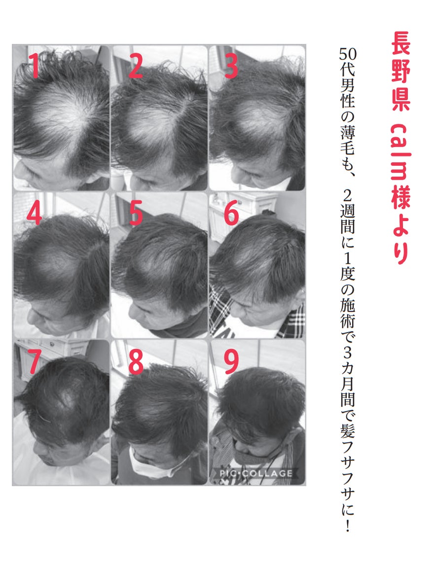 育毛のプロが正しいケアを教えます フサフサ大作戦 あなたの髪がよみがえる方法のすべて 刊行 株式会社自由国民社のプレスリリース 育毛のプロが正しいケアを教えます フサフサ大作戦 あなたの髪がよみがえる方法のすべて 刊行 株式会社自由国民社のプレスリリース