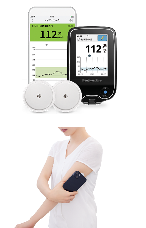 CGM（持続グルコース測定器）