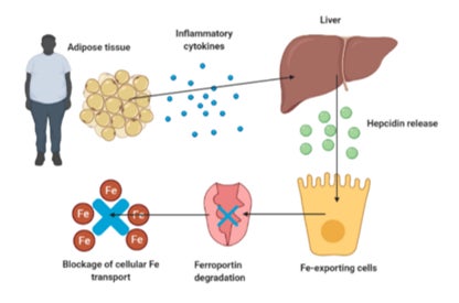 図①:肥満者における貧血の機序※3 脂肪組織から炎症性物質が分泌➡肝臓からヘプシジンが分泌➡ヘプシジンが、細胞に鉄を取り込むトランスポーターをブロック➡鉄が細胞の中に入れない➡貧血