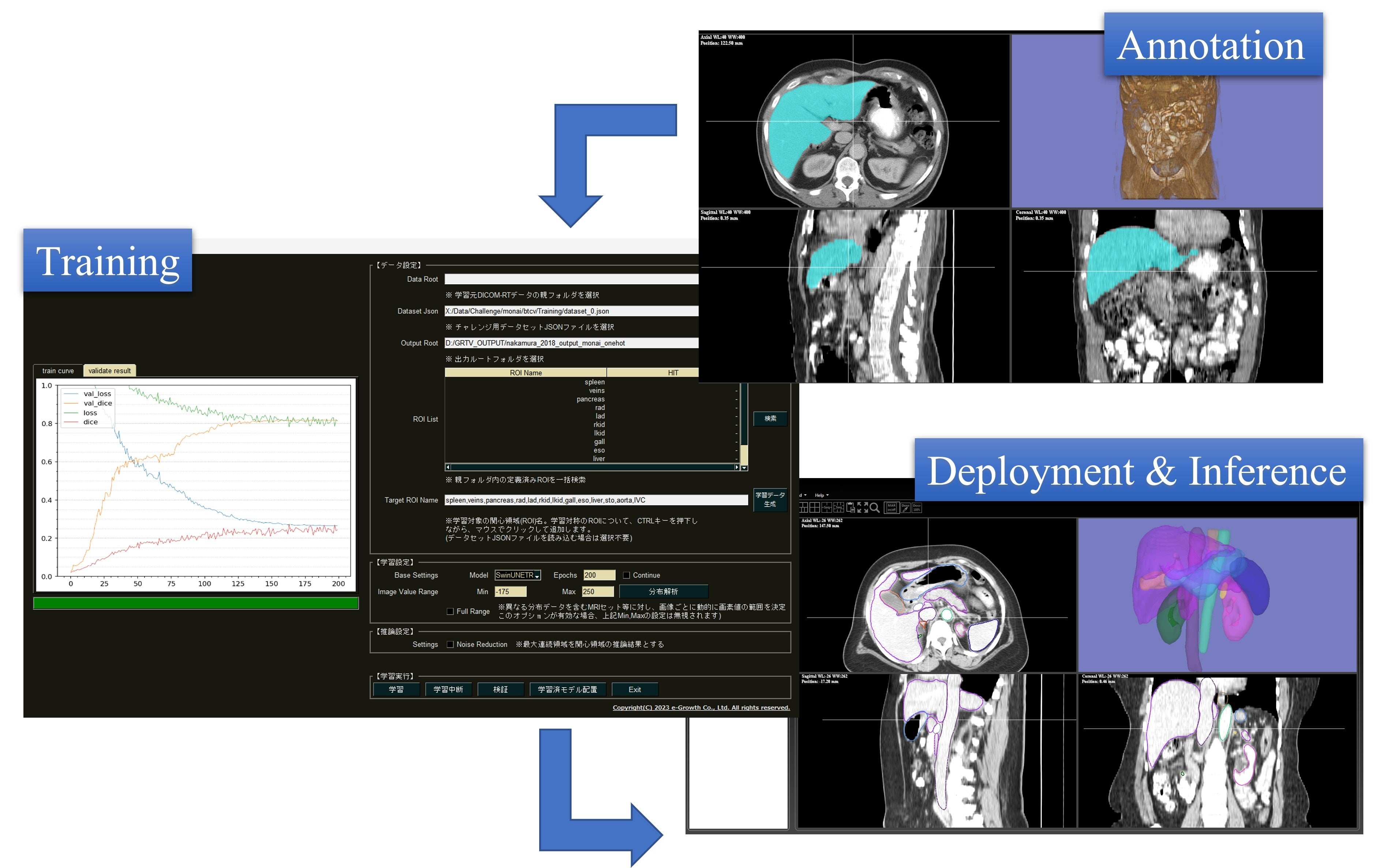ノーコード医用AI開発