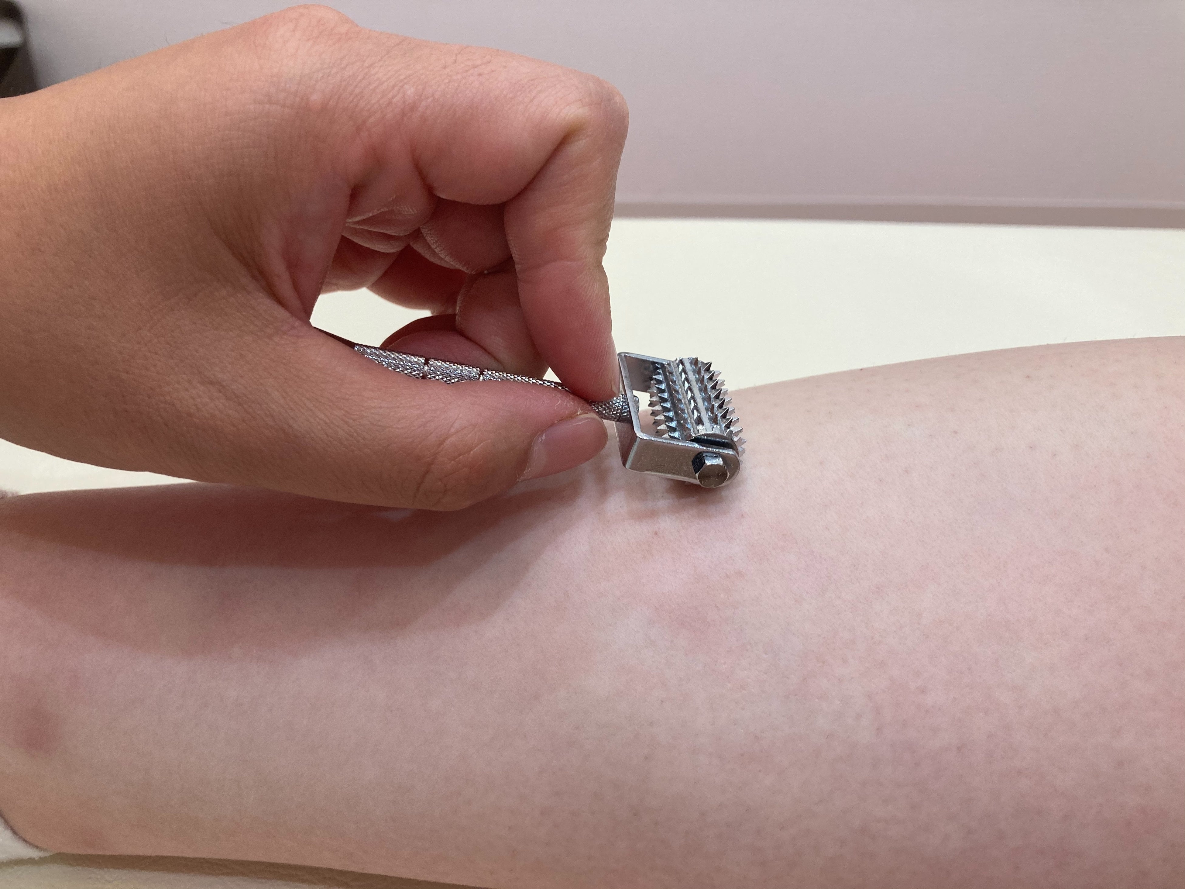 小児はり施術イメージ画像