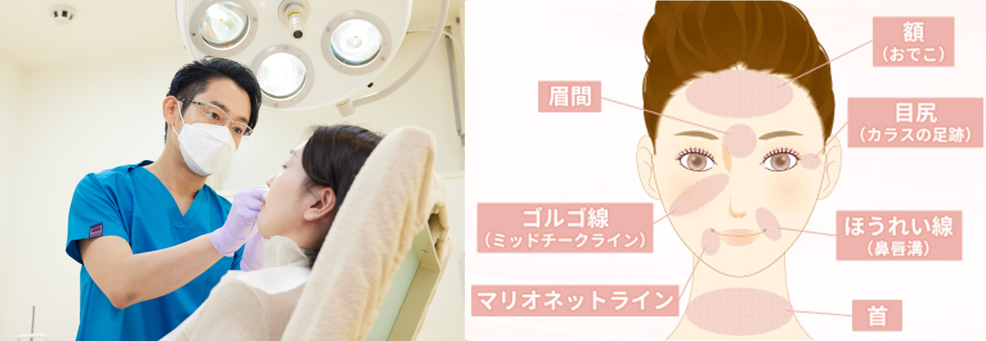 左：シワ治療は注入系が人気、右：おでこ・目元・口元などシワが気になる部位はさまざま