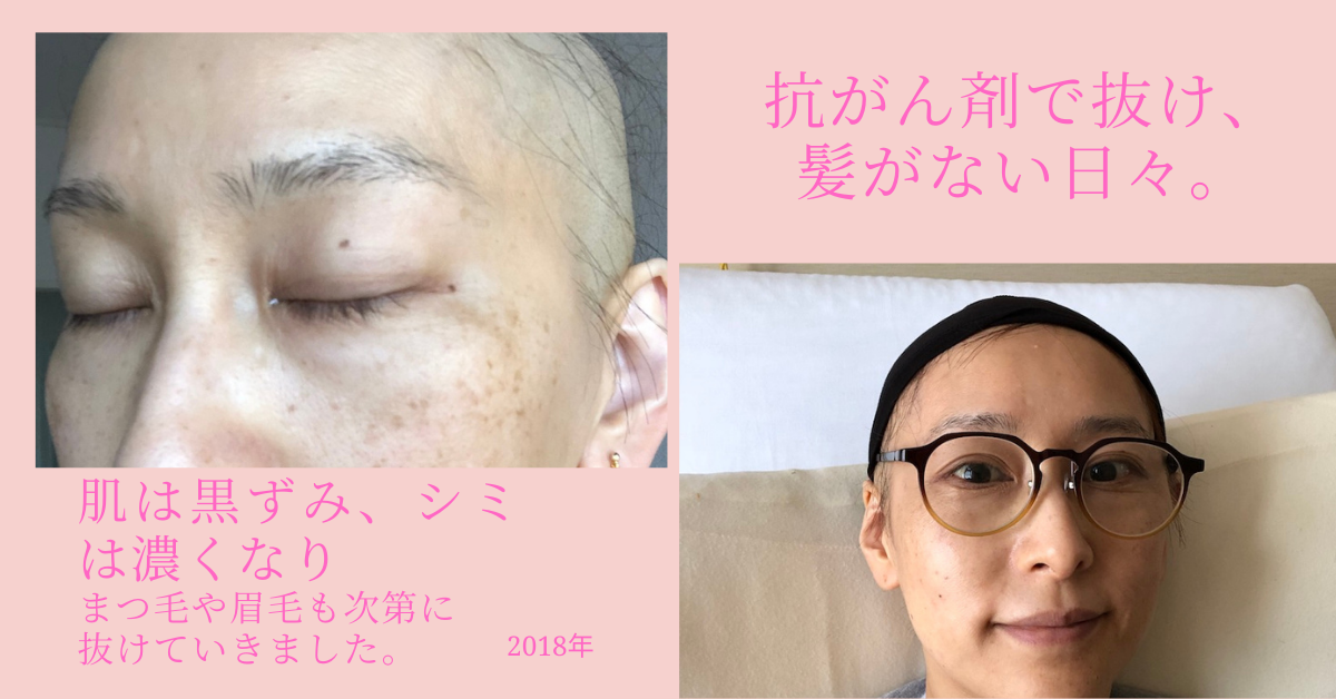 代表岸あさこ　抗がん剤治療