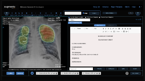 DeepTekのAI画像診断支援ソリューションの画面イメージ