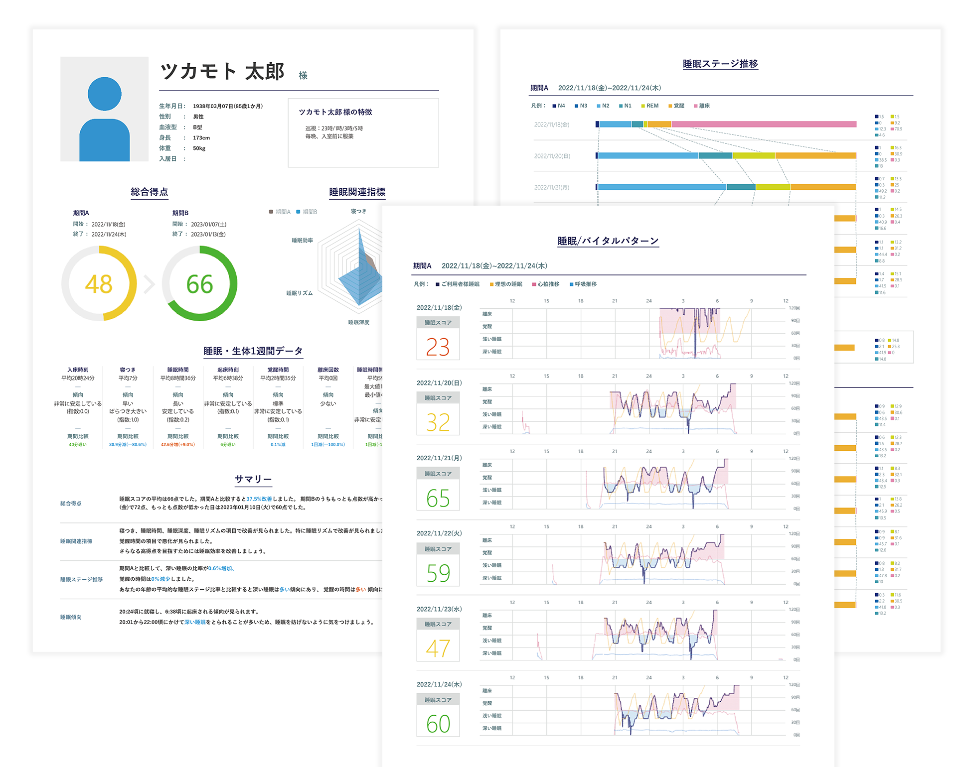 睡眠解析レポートイメージ
