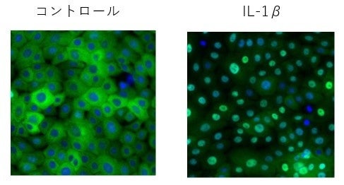 図1：炎症状態の細胞におけるNFκBの活性化