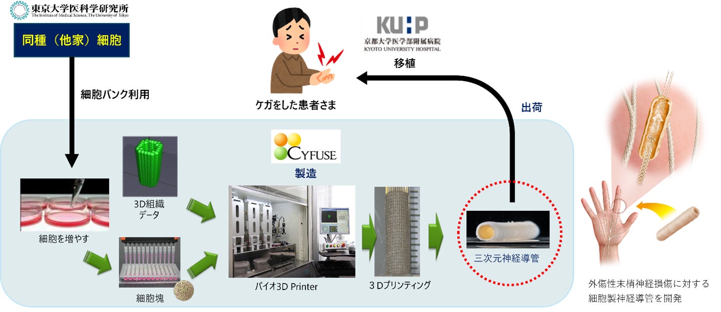 末梢神経損傷に対する同種臍帯由来間葉系細胞を用いた三次元神経導管 末梢神経損傷に対する同種臍帯由来間葉系細胞を用いた三次元神経導管