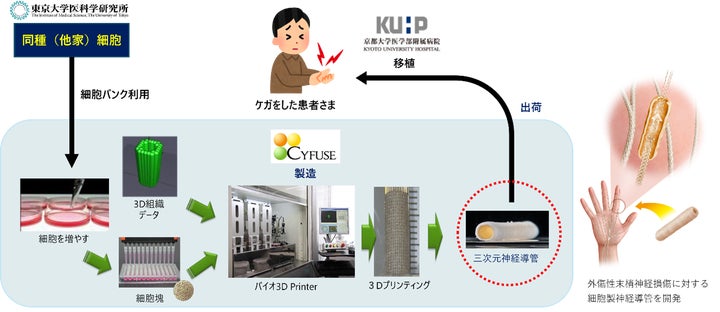 末梢神経損傷に対する同種臍帯由来間葉系細胞を用いた三次元神経導管 末梢神経損傷に対する同種臍帯由来間葉系細胞を用いた三次元神経導管