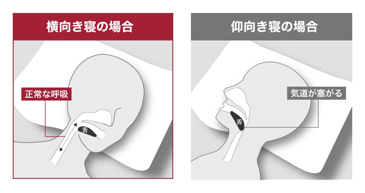 脳と睡眠を科学するブレインスリープ、睡眠時の課題解決を導く「いびき