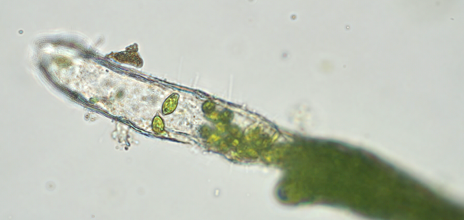 図４：形成された遊走子