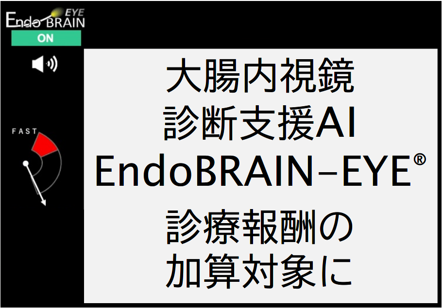 【裁断済】IBDの総合鑑別力 病態理解と内視鏡診断 Amazon.co.jp: IBDの総合鑑別力: 病態理解と内視鏡診断 : 大川