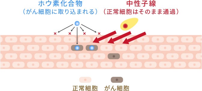 株式会社CICS(リゾートトラスト株式会社の連結子会社)、国立研究開発法人 国立がん研究センター、住友重機械工業株式会社、ならびにステラファーマ株式会社とBNCTの治験に係る契約を締結