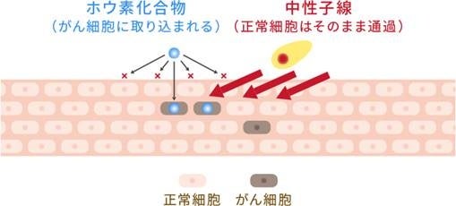 「CICSが江戸川病院と再発乳がんの特定臨床研究に協力、BNCT治療の安全性と有効性を評価」