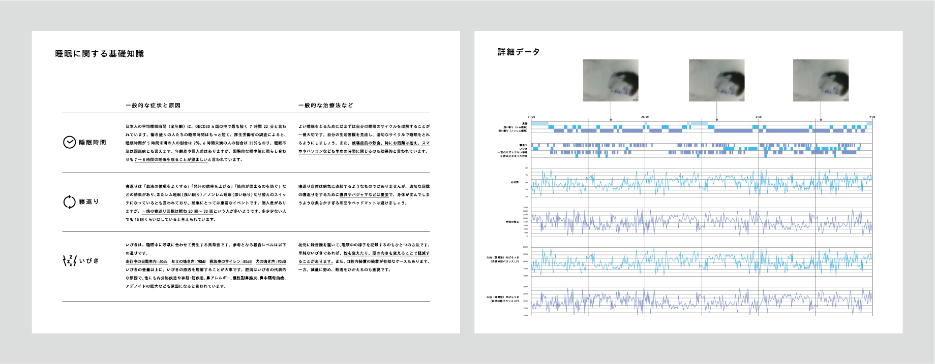 ▽睡眠解析レポートサンプル