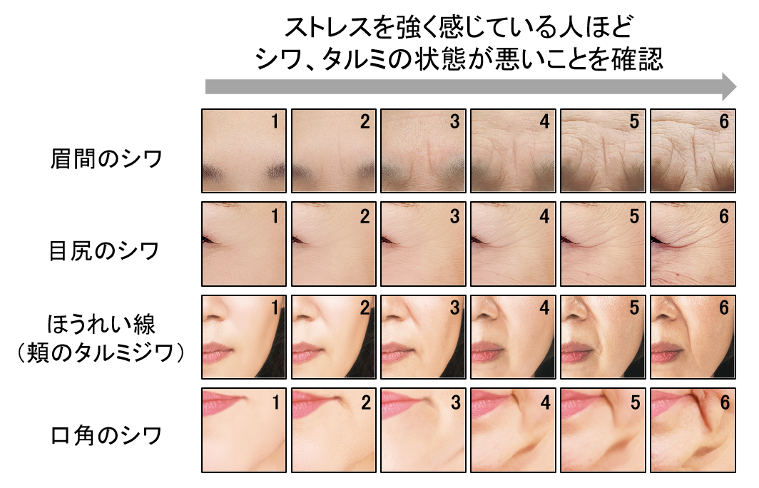 図3　シワ、タルミの状態
