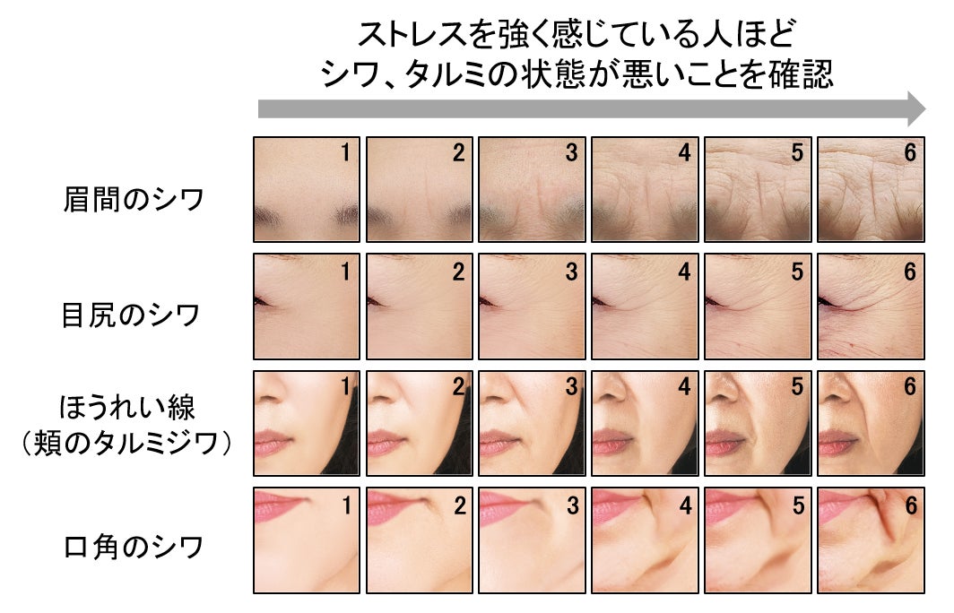 図3 シワ、タルミの状態
