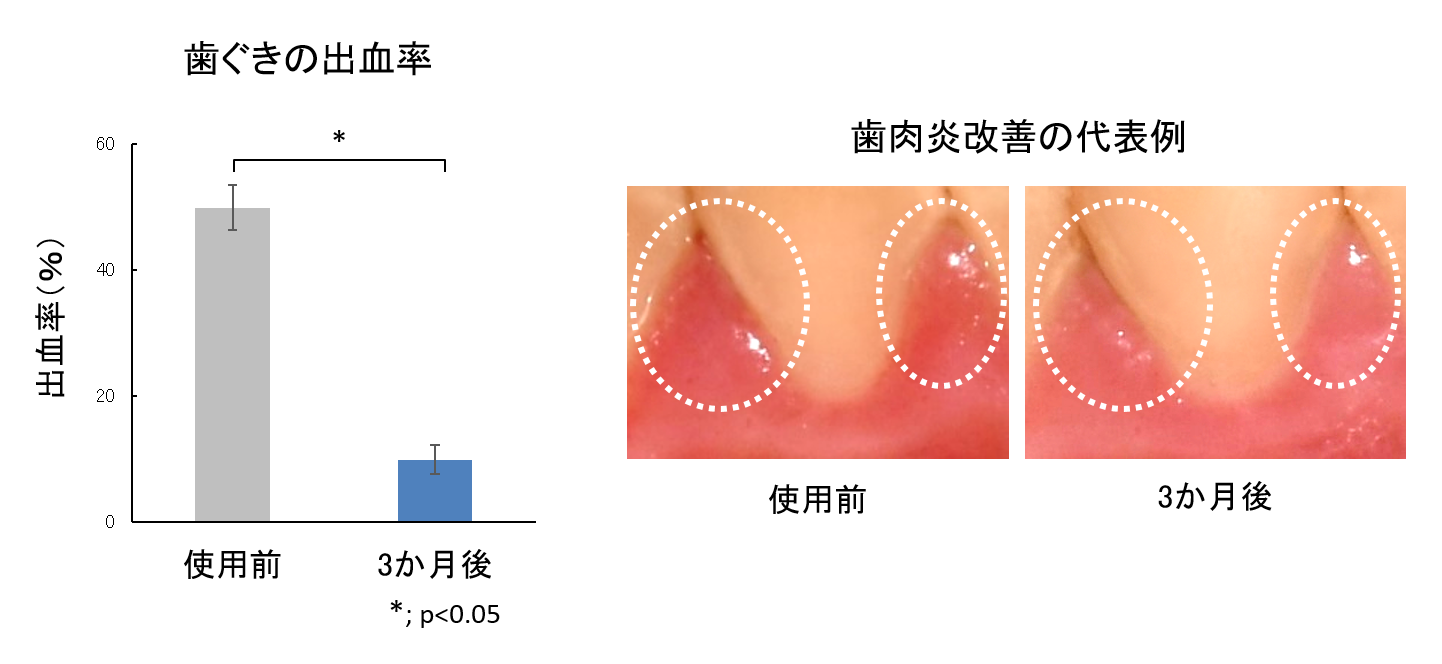 図5　3種の植物エキスを含む洗口液の歯肉炎改善効果
