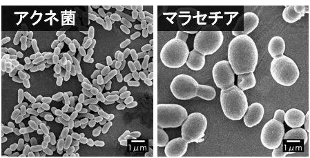 アクネ菌とマラセチアの顕微鏡写真