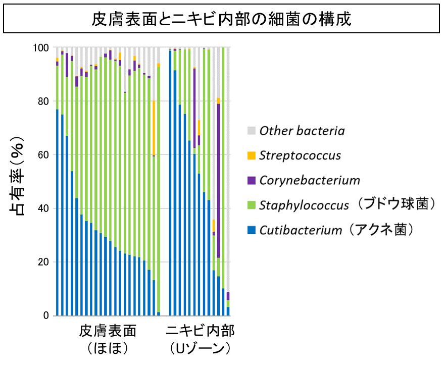 皮膚表面とニキビ内部の細菌の構成