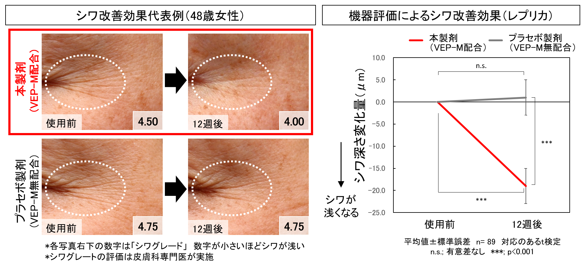 VEP-Mによるシワ改善効果