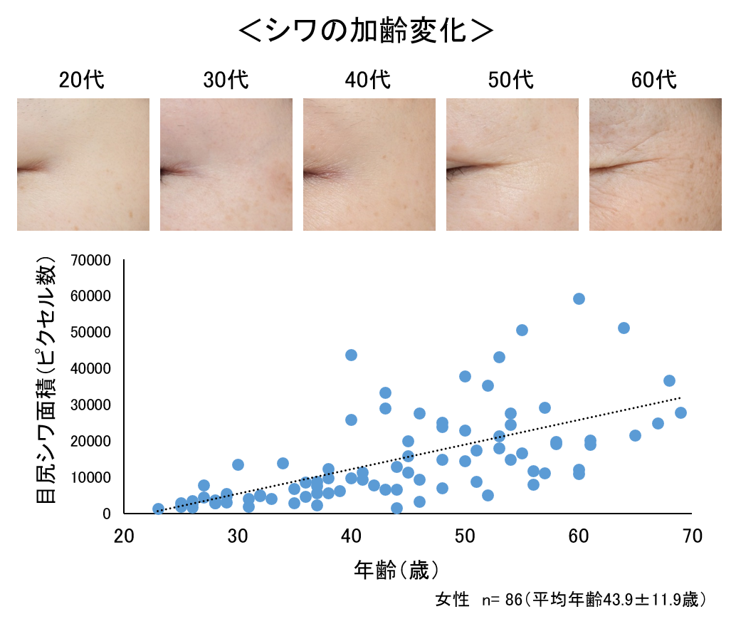 図1　シワの加齢変化