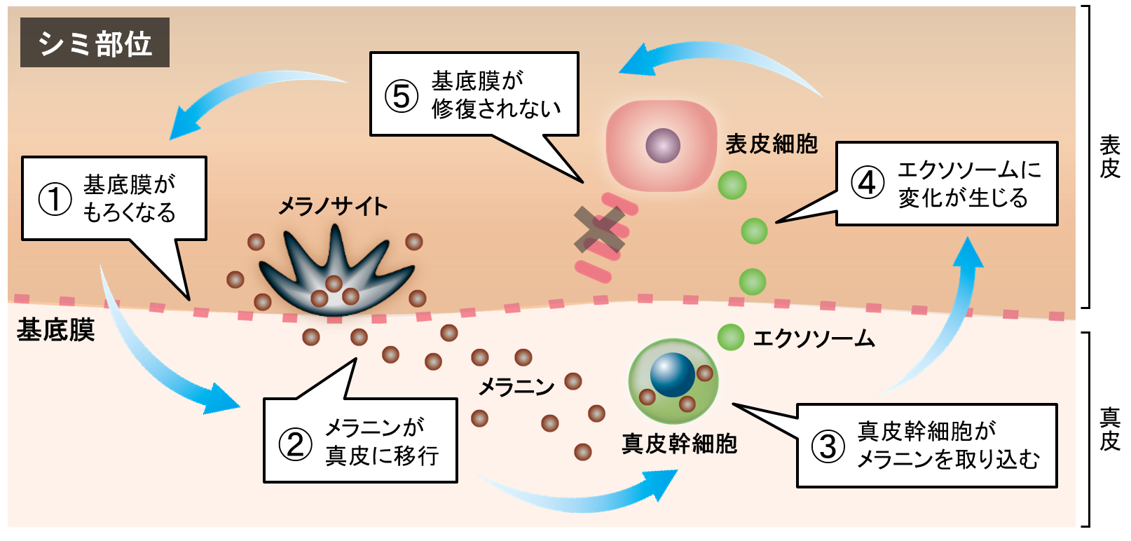 図1 シミ部位で真皮にメラニンが蓄積する負のスパイラル
