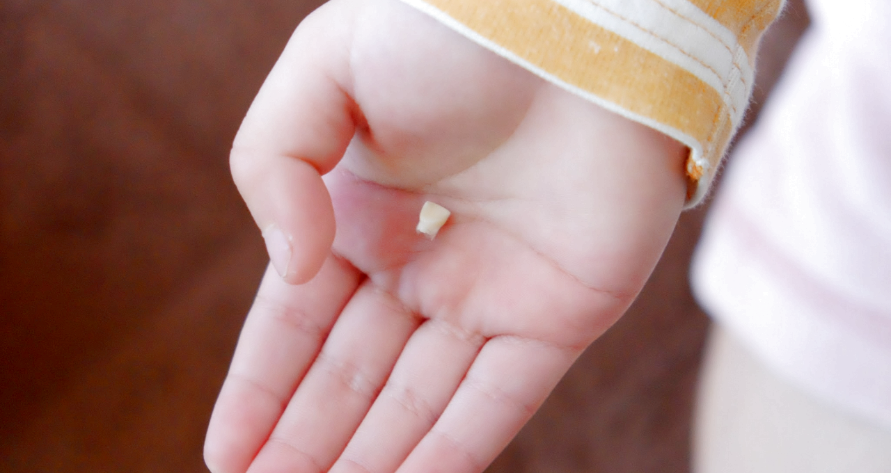 乳歯 #アンジュスマイル 乳歯ケース