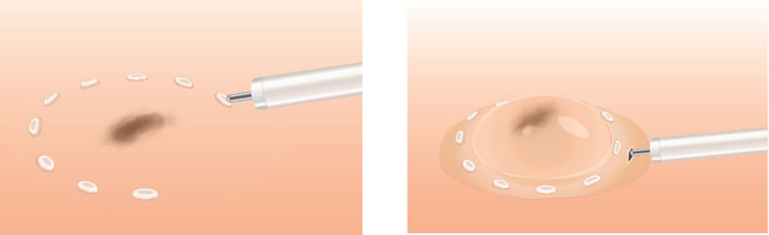 ▲左：マーキング　イメージ図、右：プレカット　イメージ図