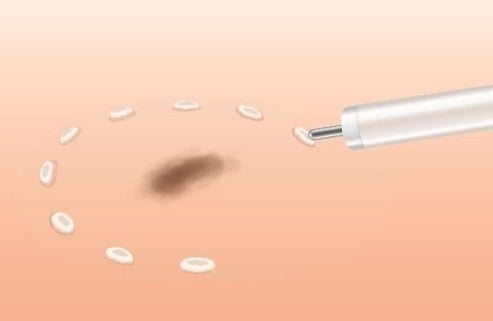 左：マーキング　イメージ図