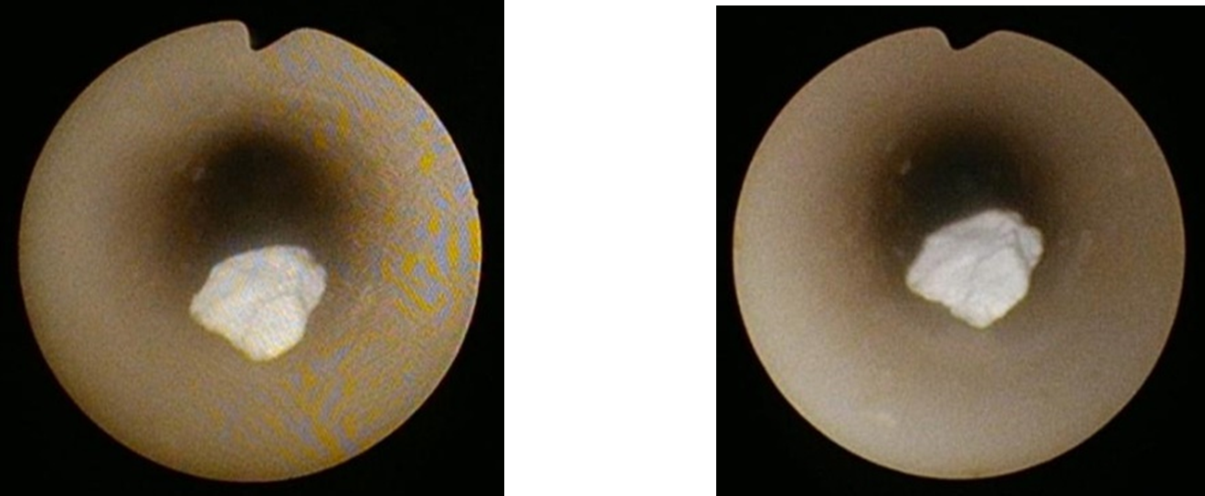 左：従来機種、右：OES ELITE ウレテロレノスコープ