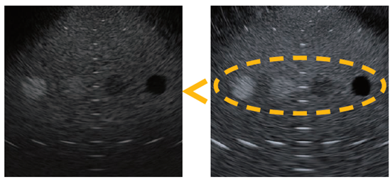 ▲左：従来機種、　右：EU-ME3