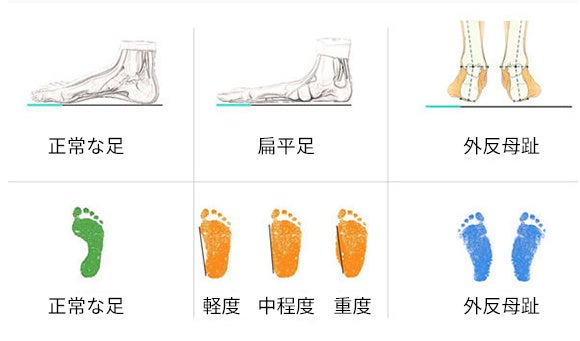 履き心地がいい 独自技術で衝撃を吸収 足裏のアーチをサポート 3dインソール Jeet 香港揚名 ホンコンヤンミン のプレスリリース 履き心地がいい 独自技術で衝撃を吸収 足裏のアーチをサポート 3dインソール Jeet 香港揚名 ホンコンヤンミン のプレスリリース