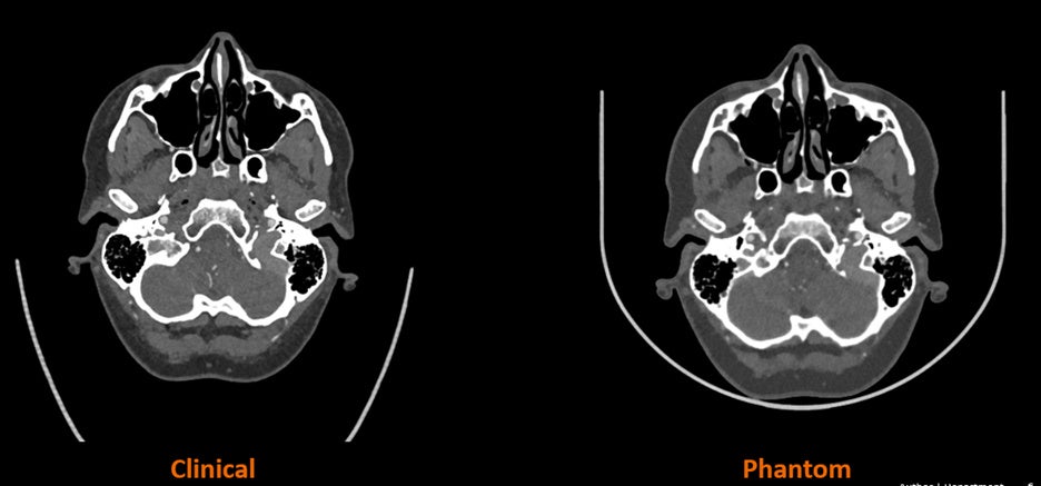 3Dプリンタを使用すれば、医師が実際のシナリオで練習したり相談したりできる3Dモデルにより、治療成績が向上する可能性をもたらす。(写真:Business Wire)