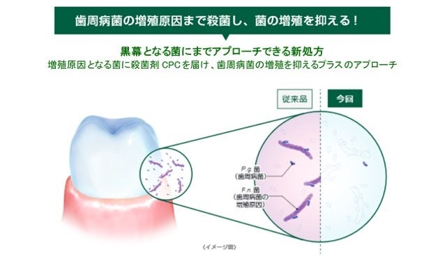 図1：G・U・M史上初の殺菌アプローチ