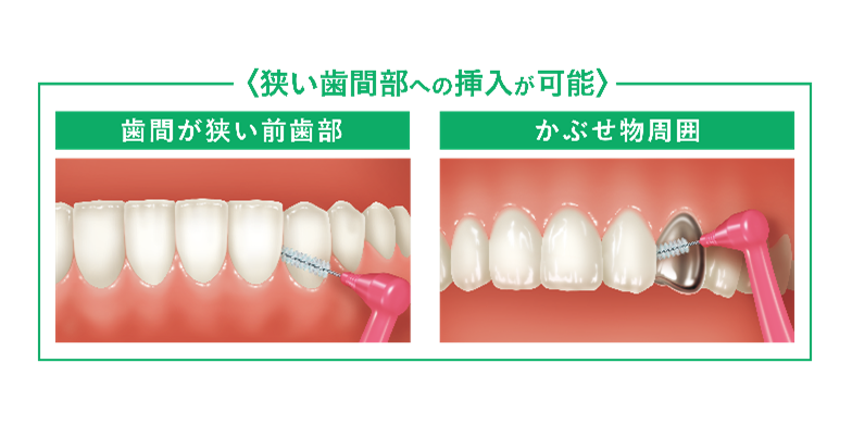 G・U・Mシリーズ最細サイズ「歯間ブラシL字型SSSS（0）」新発売 | サン