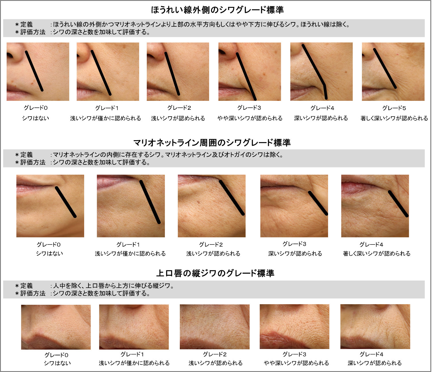 図4．シワ標準グレード