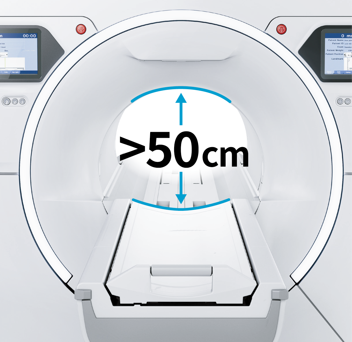 SIGNA™ Champion ボア径