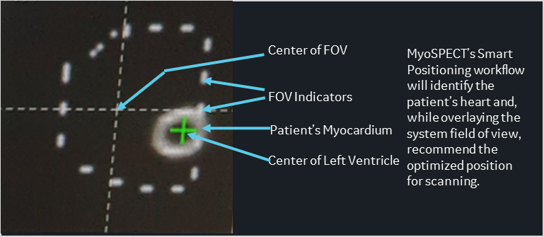スマートポジショニングによる自動位置合わせ