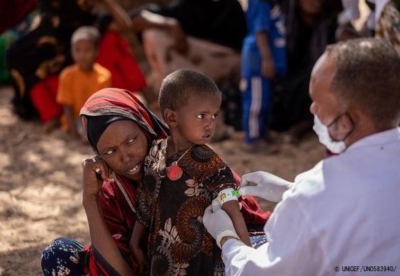 上腕計測メジャーを使い栄養状態のチェックを受ける2歳の女の子。下痢と嘔吐の症状があり治療を受けている。(エチオピア、2022年1月20日撮影) © UNICEF_UN0583940_