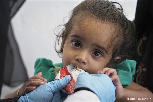 ハッジャ州の移動診療所で、すぐに食べられる栄養治療食(RUTF)を口にするマラムちゃん。(イエメン、2021年11月撮影) © UNICEF_UN0582347_