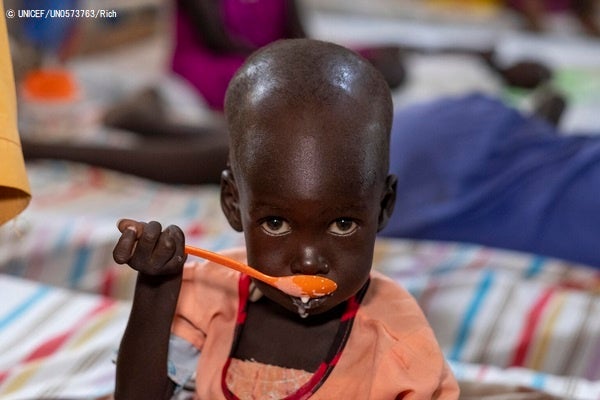 南スーダンの病院で栄養不良の治療を受ける1歳半のニャジャルちゃん。（2021年11月撮影）© UNICEF_UN0573763_Rich