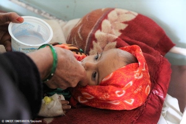 重度の急性栄養不良に苦しむ生後18カ月の赤ちゃん。カンダハールにある病院で治療を受けている。(アフガニスタン、2022年1月撮影)© UNICEF_UN0596039_Qayoumi