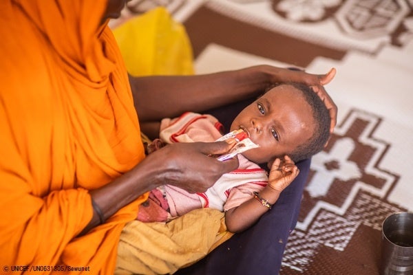 栄養不良の診断を受け、すぐに食べられる栄養治療食(RUTF)を口にする子ども。干ばつの影響で家を追われ、国内避難民キャンプで暮らしているときに、ユニセフの保健・栄養チームの診察を受けた。(エチオピア、2022年4月撮影) ©  UNICEF_UN06313